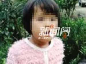 幼童玩火燒傷親姐 究竟是怎麼回事？