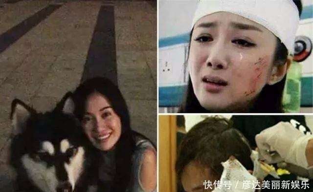 她曾是最美古装女神 遭恶犬咬伤致毁容 今在 司藤 中演技炸裂 楠木轩