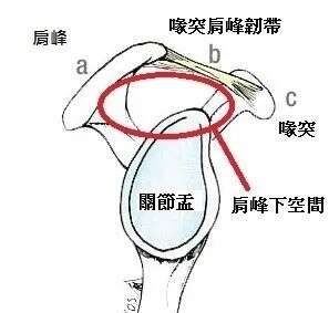 肩夹挤 肩周炎 肩夹挤治疗的迷思 楠木轩